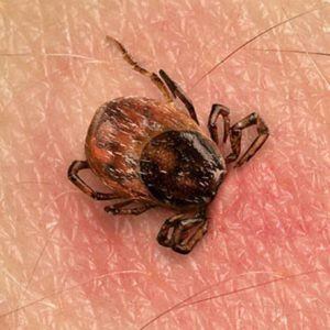 Ticks